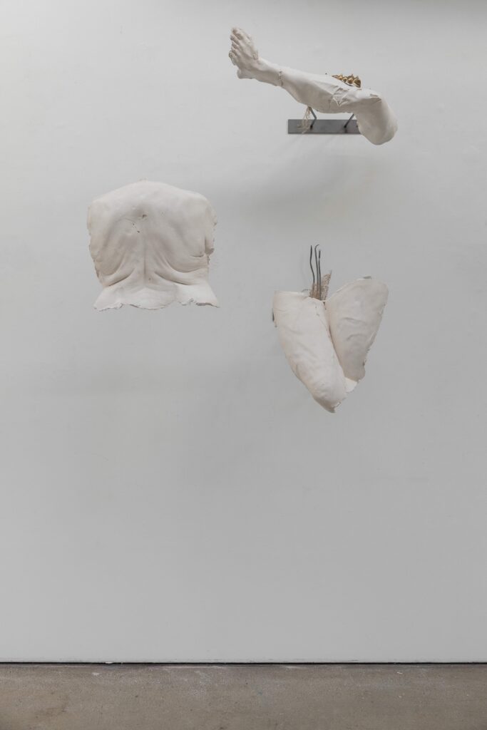 Abi Joy Samuel, Socially Sanctioned Prosthetics I, 2026. Courtesy of the artist.